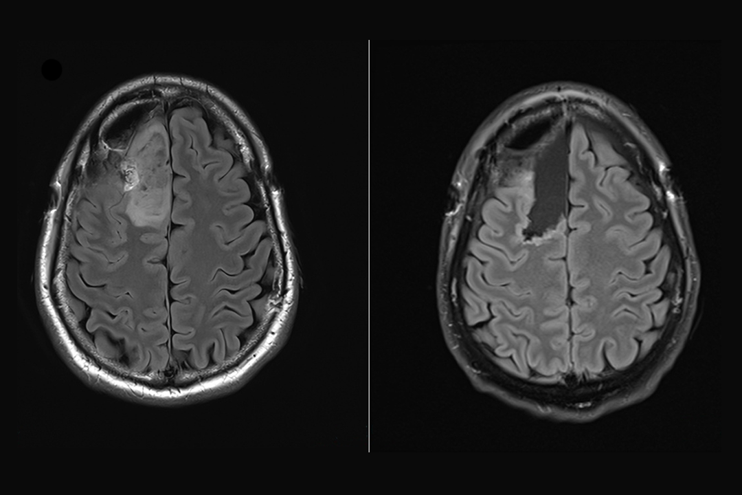 BrainPOP Brain Scans Image